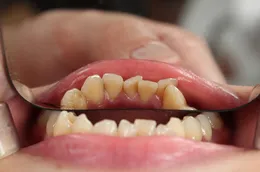 dobry dentysta bielsko